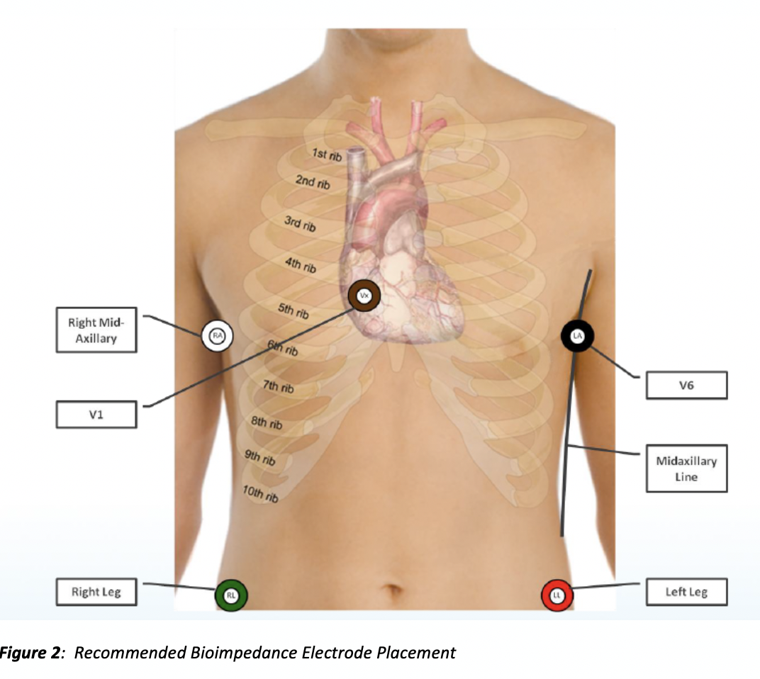 Shimmer3 Bioimpedance Monitor - Monitoring HR, respiration rate and depth, and the increase in fluid in the lungs to triage and re[…]