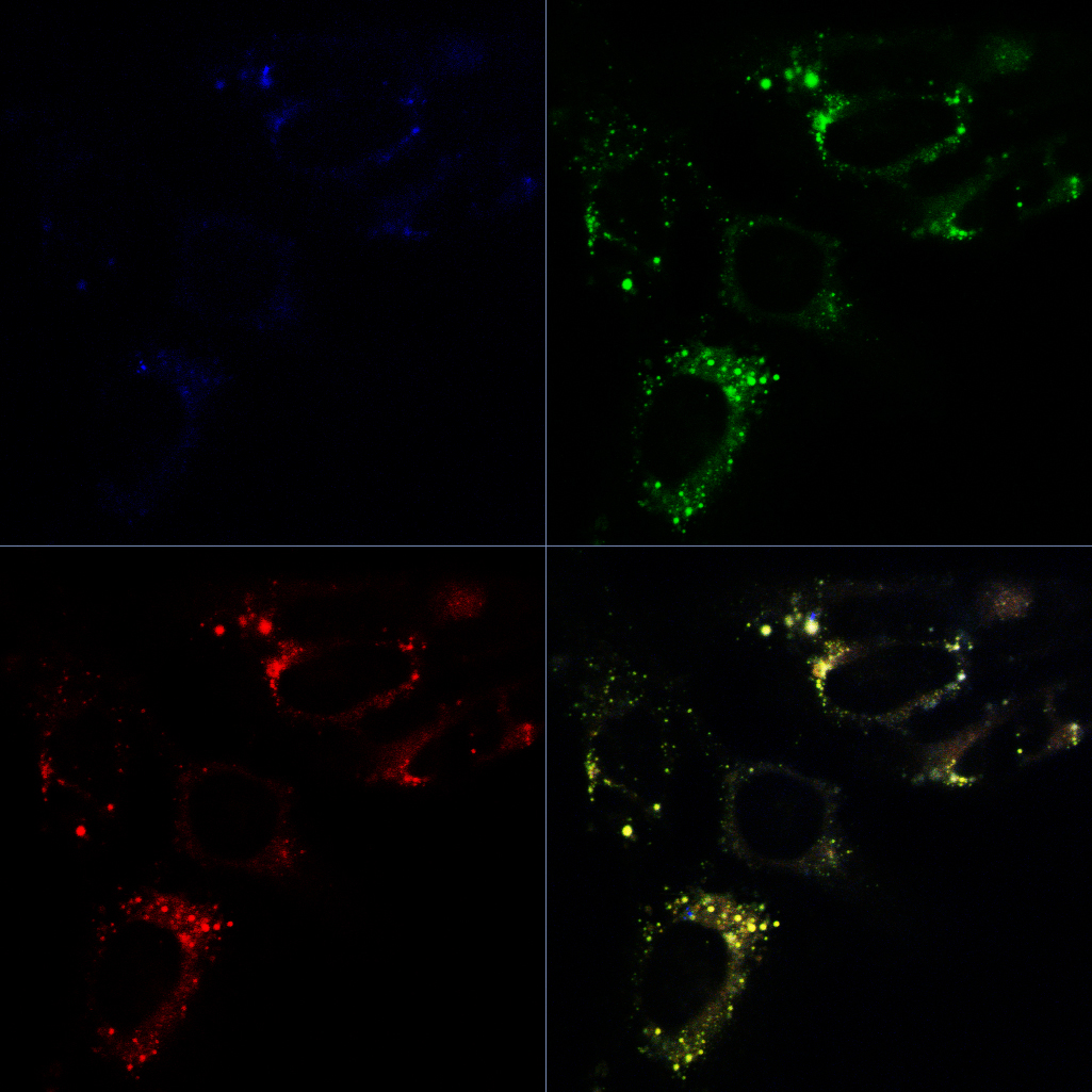 LipidPro - Fluorescent dye for detection of lipid aggregates in living cells and other samples