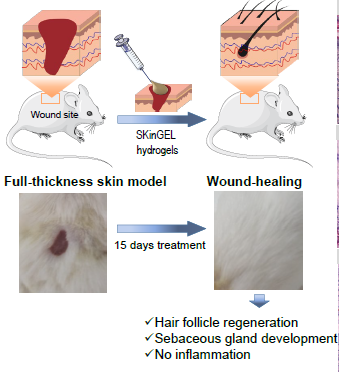 Nanoenabled hydrogels for advanced skin care : SkinGel